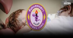 สื่อสารคลาดเคลื่อน! ทันตแพทยสภา แจงยื่นทบทวนสิทธิ ‘ผ่าฟันคุด’ ประกันสังคม ทันตแพทยสภา