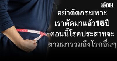 ตัดกระเพาะ