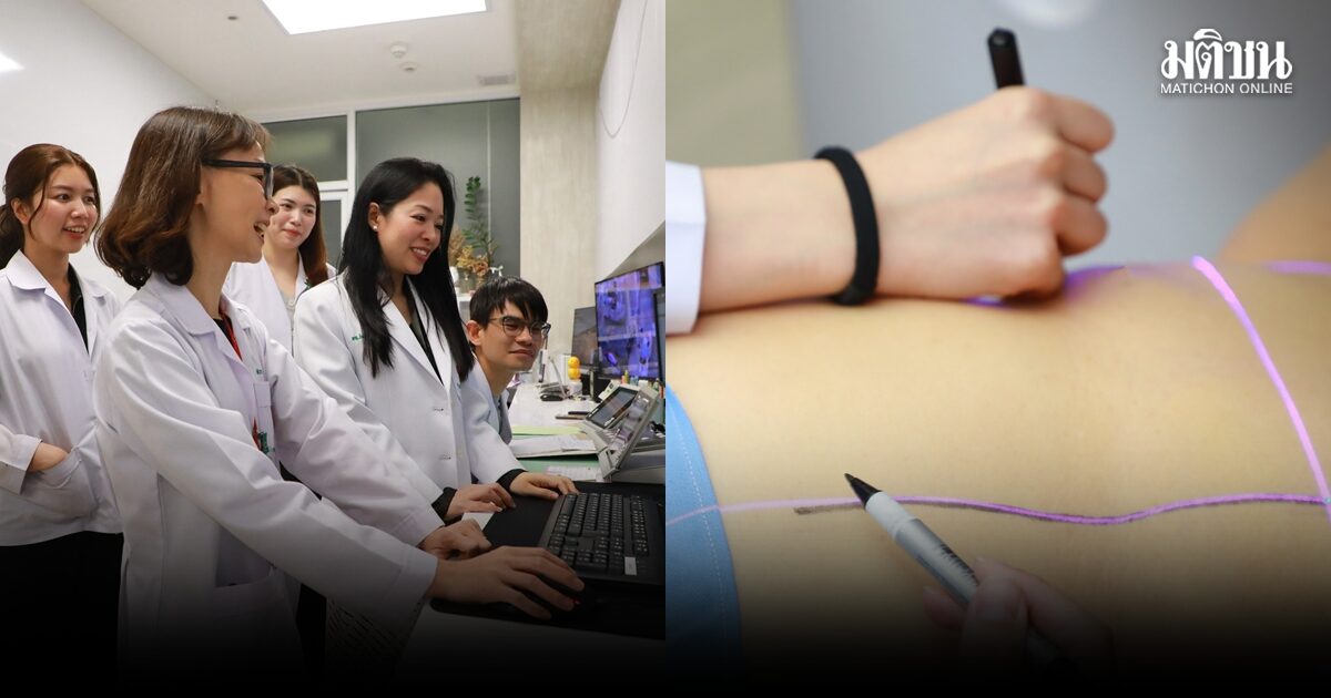 สุดเจ๋ง!รพ.จุฬาฯฉายรังสีมะเร็งเต้านมไม่ขีดเส้น ชูเทคโนโลยี ‘SGRT’ แม่นยำเทียบวิธีเดิม