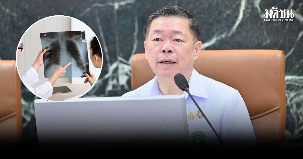 กรมควบคุมโรค เตือนคนไทยระวัง ‘วัณโรค’ยังระบาดหนัก ยันไม่ติดต่อผ่านการกิน-ดื่มน้ำร่วมกัน