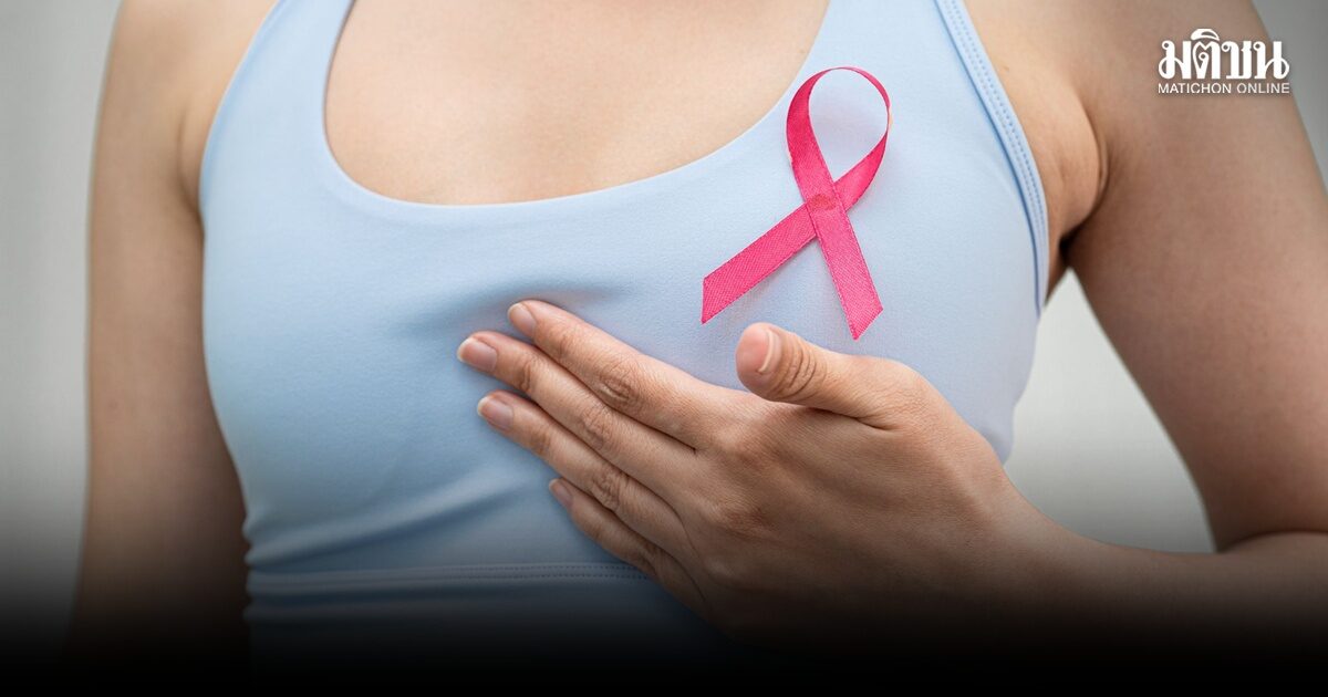 รู้ทัน ‘มะเร็งเต้านม’ แพทย์เตือน คลำไม่พบก้อนไม่ได้แปลว่าไม่เป็น แนะอย่าละเลยการตรวจคัดกรอง