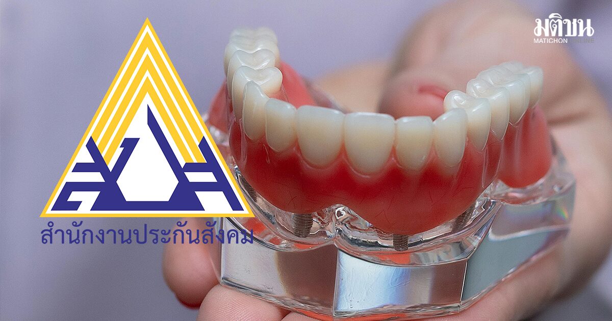 เริ่ม 1 พ.ค. เพิ่มสิทธิทำฟันประกันสังคม ปรับวงเงินฟันปลอมสูงสุด 6 พันบาท เช็กเงื่อนไขทั้งหมด