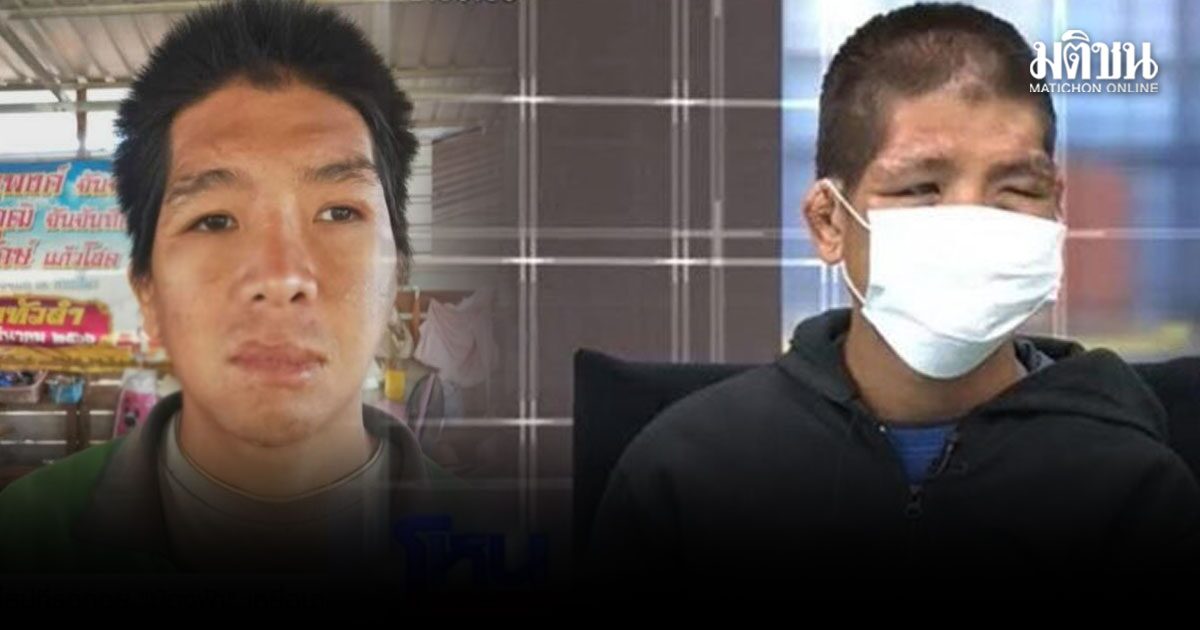 เปิดใบหน้า ไร้รีทัช ฟ้า ถูกนายจ้างทารุณ เจ้าตัวพอใจแล้ว กลับไปใช้ชีวิตใหม่ เลี้ยงไก่ ที่บ้าน