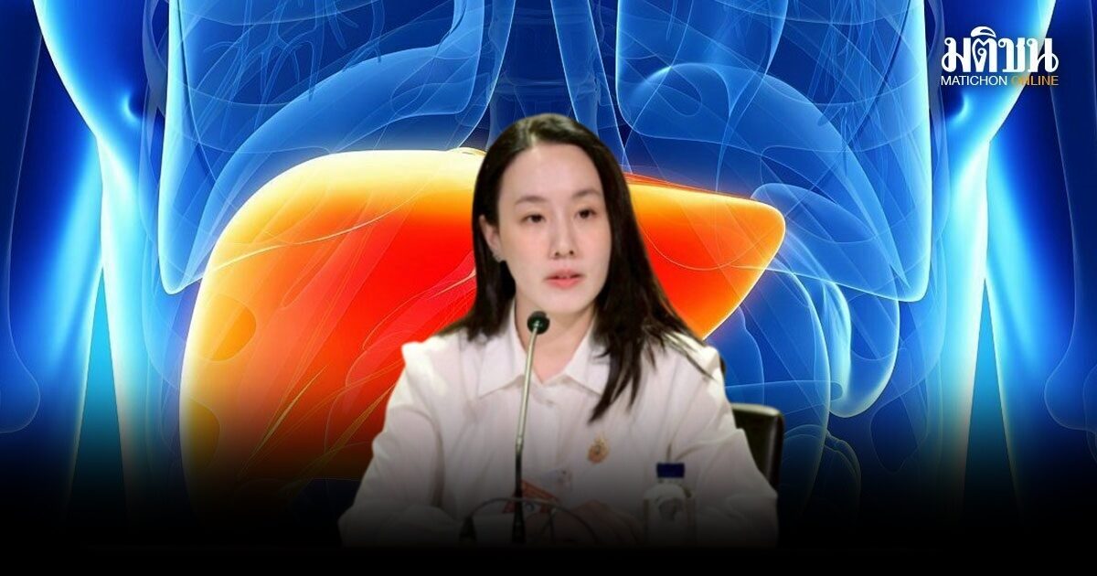 เตือนปชช. ระวัง ตับอักเสบเอ พบป่วยพุ่ง 2 เท่าในหน้าร้อน กระจุกตัวภาคกลาง-ตะวันออก