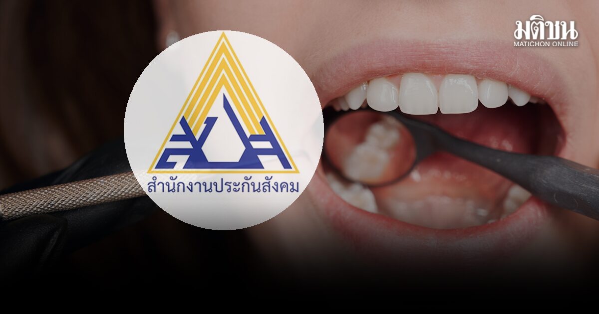 ดีเดย์พรุ่งนี้! ประกันสังคม ผ่าฟันคุด ไม่เกิน 2,500 บาท-ฝังรากเทียมรองรับฟันเทียมทั้งปาก