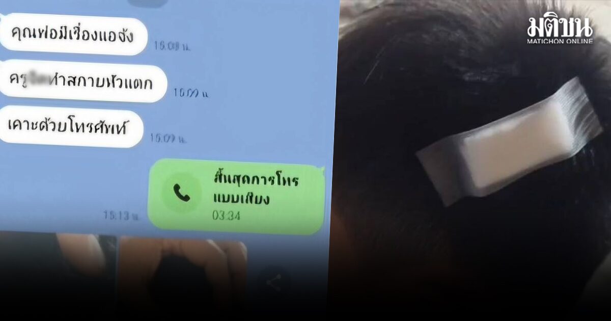 ครูสอนพิเศษ โมโหเด็ก7ขวบ ทำแบบทดสอบผิด3ข้อ ใช้มือถือฟาดหัวเลือดอาบ ขอจ่ายชดเชย500
