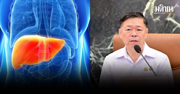 ควบคุมโรค-ตับอักเสบเอ