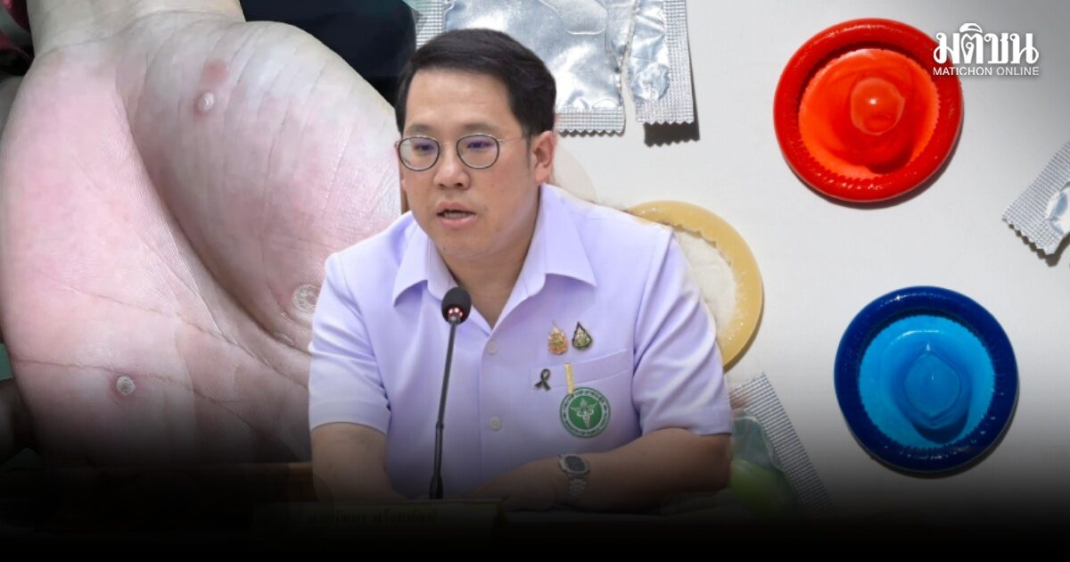 ‘พัฒนา’ เปิดสัญญาณ 6 โรคเฝ้าระวัง เผยพบป่วย ‘ซิฟิลิส’ พุ่งสูงในวัยรุ่น