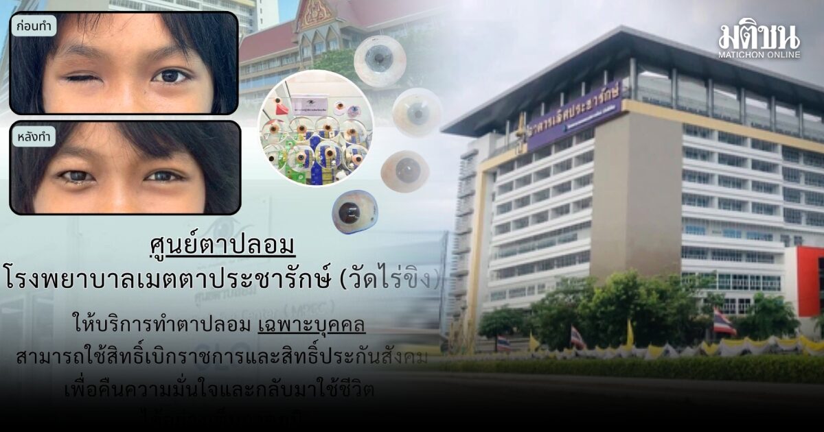รพ.เมตตาประชารักษ์ เปิดรับทำ ‘ลูกตาปลอม’ สิทธิประกันสังคม หวังคืนความมั่นใจให้ผู้ประกันตน