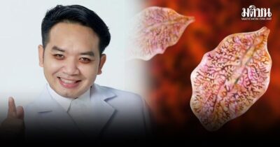 พยาธิใบไม้ตับ